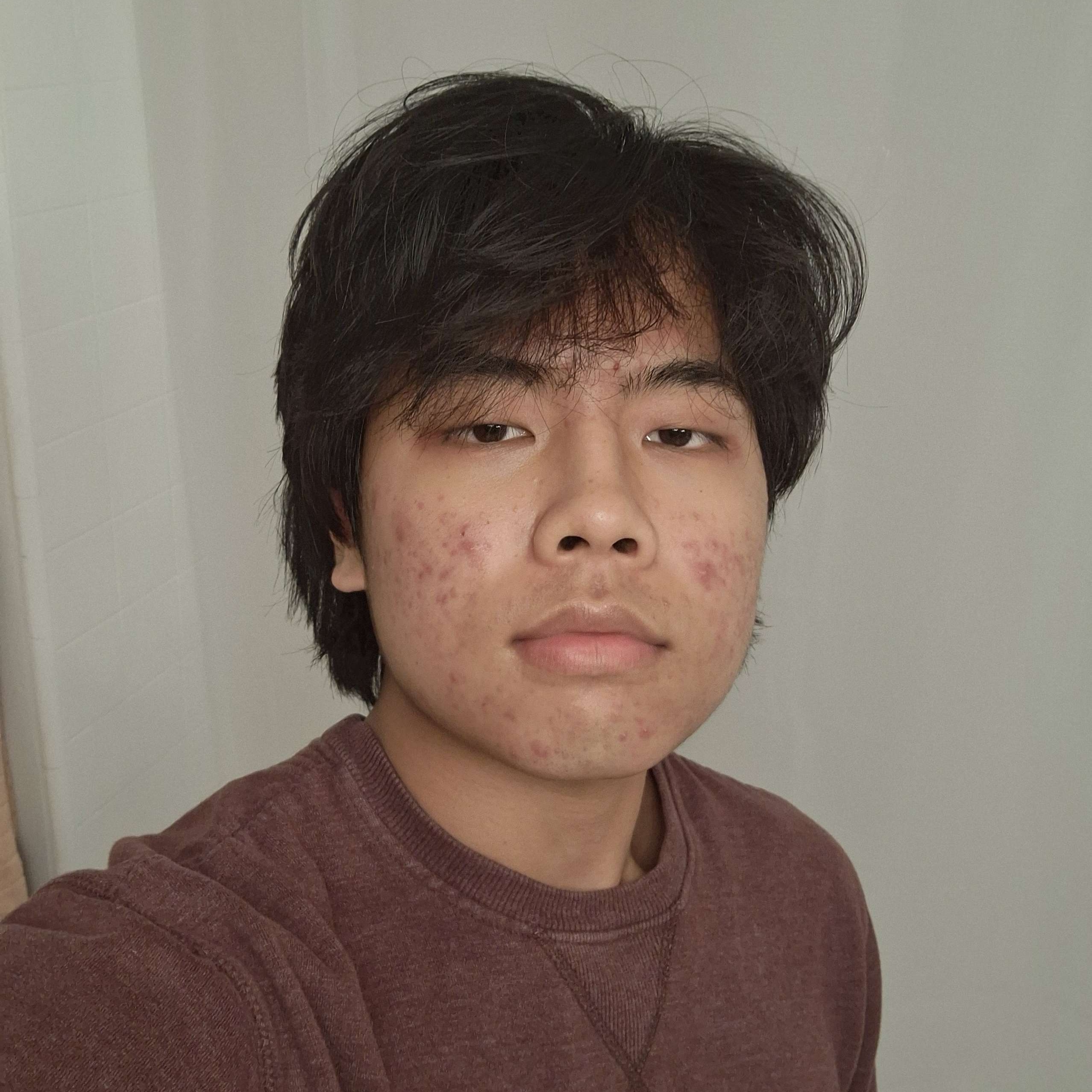 Siwoo Choi